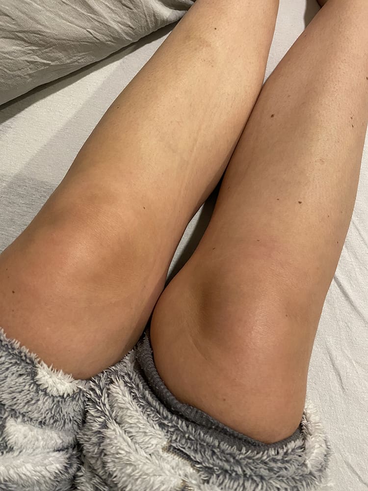 mijn gekke kwaaltjes